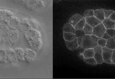 cleft closure - DIC and CED-10::GFP