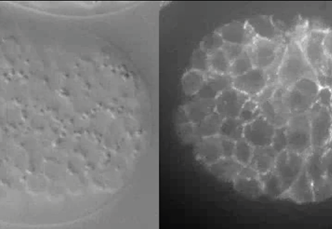 ventral enclosure - DIC and HMP-1::GFP