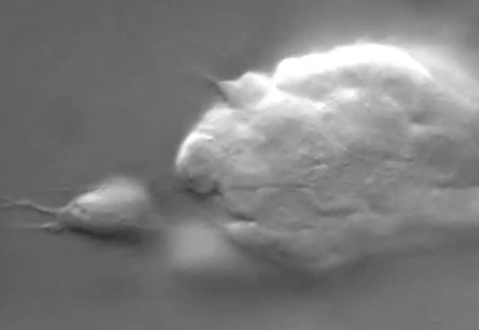 L. pictus archenteron - DIC