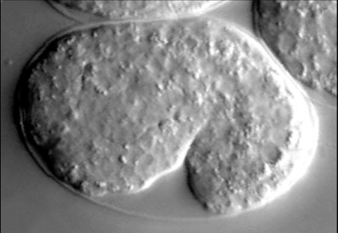 elongation - hmp-1(fe4);jac-1(RNAi)