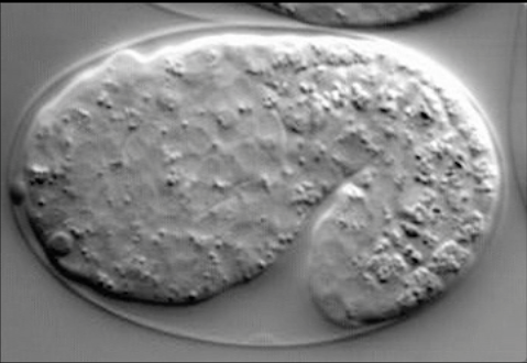 elongation - hmp-1(fe4)