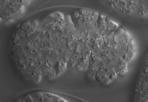 elongation - hmr-1(tm5601)