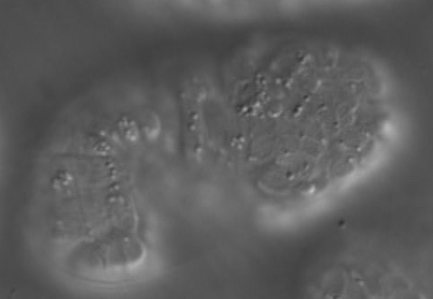 hmr-1 = DIC - dorsal