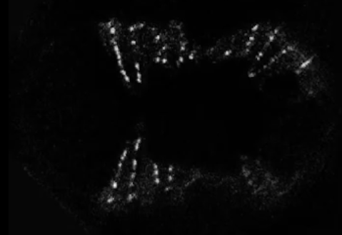 let-413(RNAi) - AJM-1::GFP