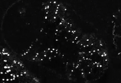 let-413(RNAi) - DLG-1::GFP