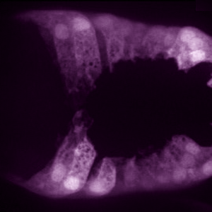 Pdlg-1::GFP