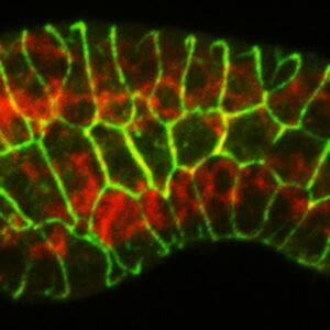 muscle (red) /AJM-1 (green)