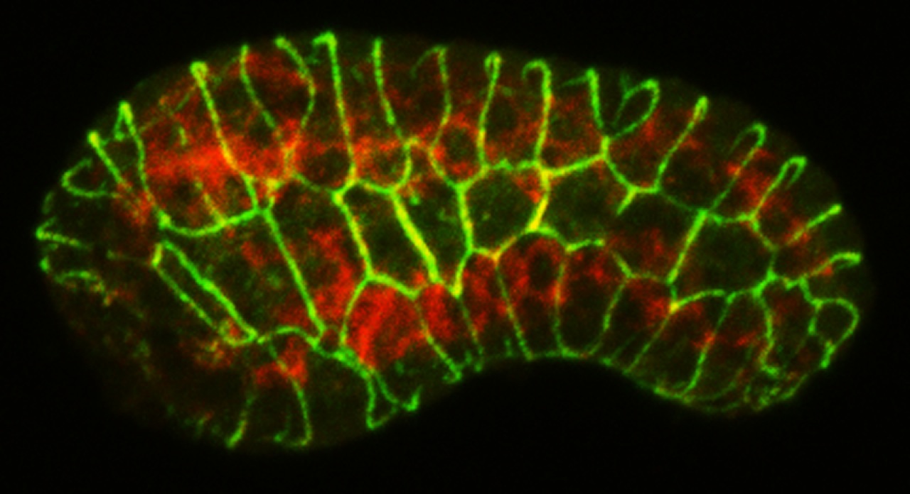 muscle (red) /AJM-1 (green)