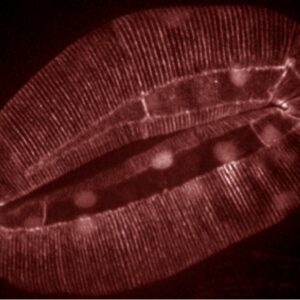 Pvab-10::ABD::gfp