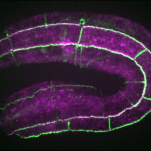 JAC-1::GFP/UNC-94 (purple)