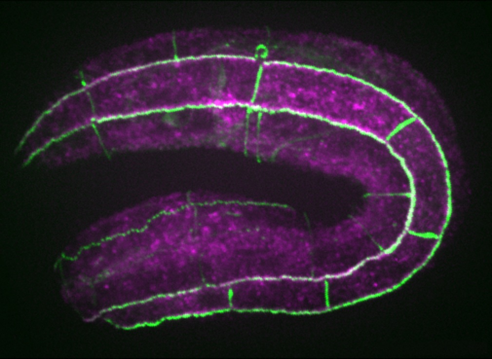 JAC-1::GFP/UNC-94 (purple)