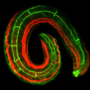 JAC-1::GFP (green)/actin (red)
