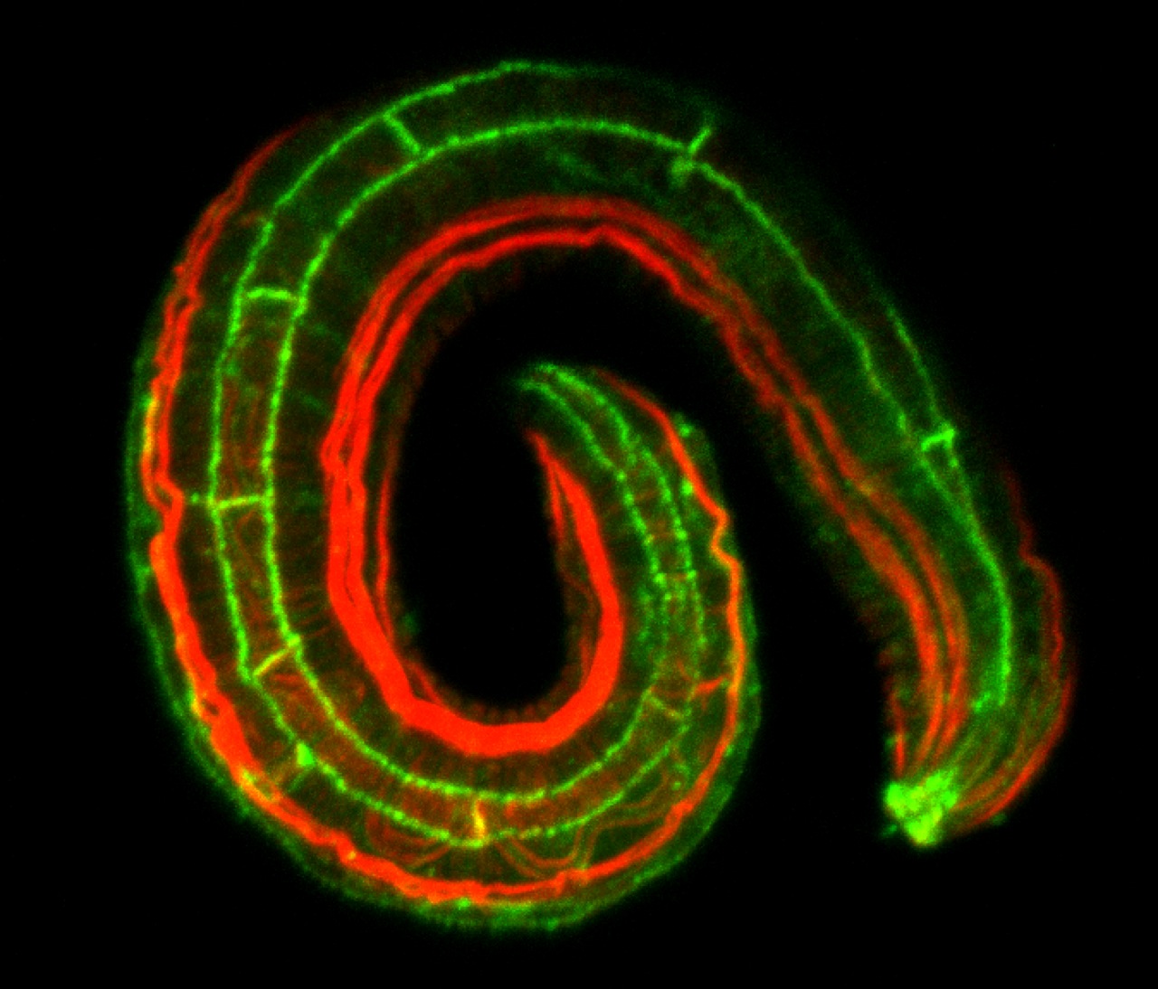 JAC-1::GFP (green)/actin (red)