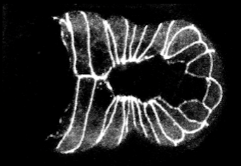 ventral enclosure - DLG-1::GFP