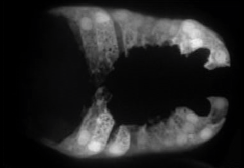 ventral enclosure - Pdlg-1::gfp