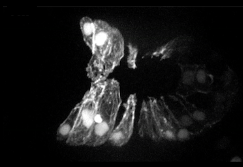 ventral enclosure - F-actin