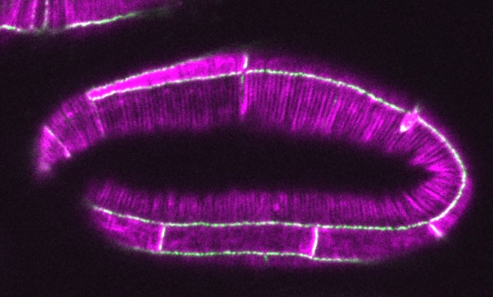 HMP-1 (green)/LifeAct (magenta)