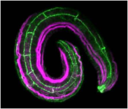 actin magenta AJM-1 green