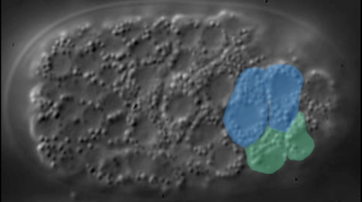 dorsal intercalation -colorized