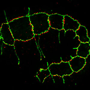 AJM-1::GFP (red)/HMP-1 (green)