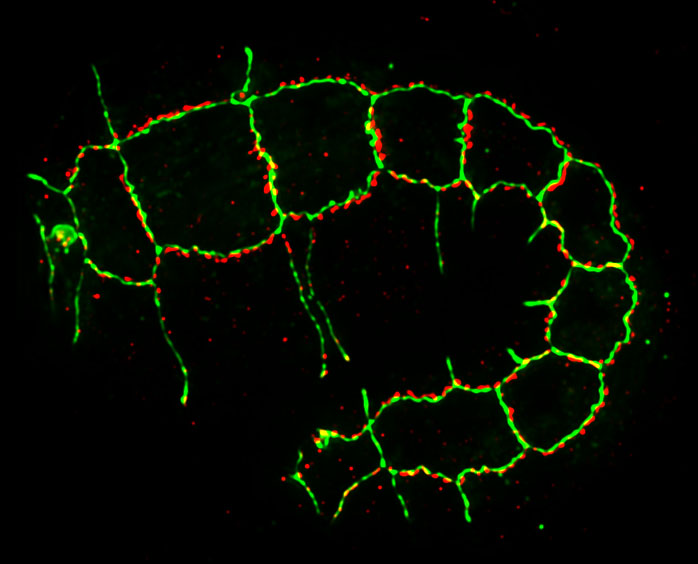 AJM-1::GFP (red)/HMP-1 (green)