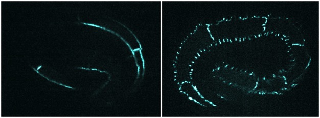 hmp-2 wild-type vs. phosphomutant