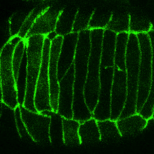DLG-1::GFP - intercalation