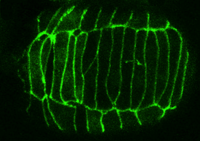DLG-1::GFP - intercalation