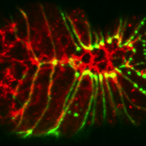 AJM-1 (green)/actin (red)