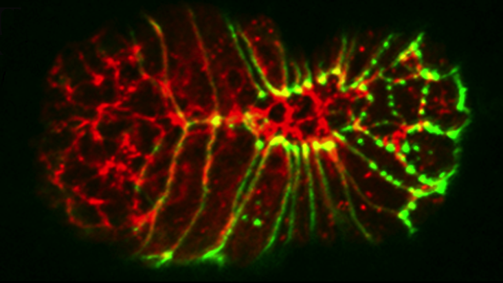 AJM-1 (green)/actin (red)