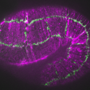 Actin (purple)/JAC-1::GFP (green) in fe4