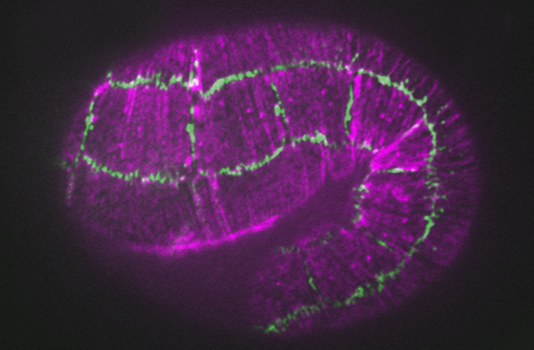 Actin (purple)/JAC-1::GFP (green) in fe4