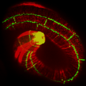 AJM-1::GFP (green)/
actin (red)