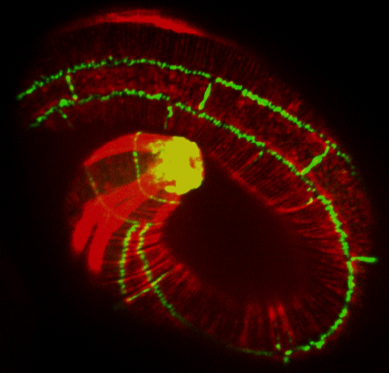AJM-1::GFP (green)/
actin (red)
