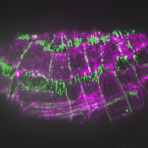 Actin (purple)/JAC-1::GFP (green) in fe4;unc-94(RNAi)
