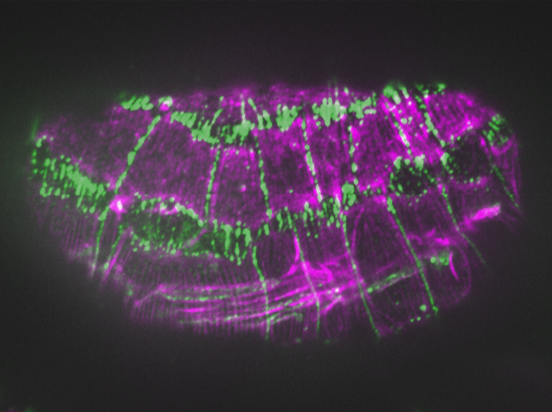 Actin (purple)/JAC-1::GFP (green) in fe4;unc-94(RNAi)