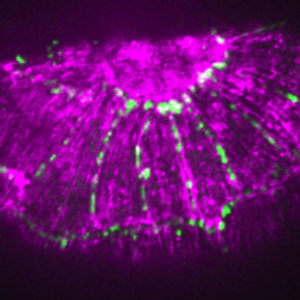 Actin (purple)/HMP-1 deltaC (green) in zu278