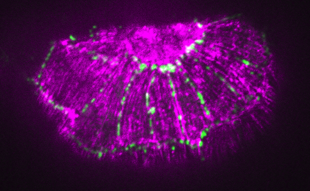 Actin (purple)/HMP-1 deltaC (green) in zu278