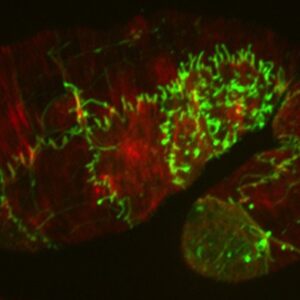 SRGP-1::GFP (green)/actin (red)