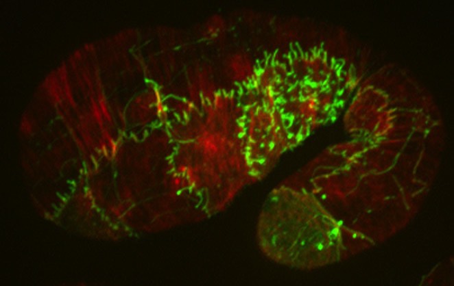 SRGP-1::GFP (green)/actin (red)