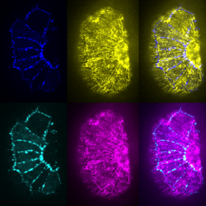 Actin/delta-C term HMP-1
a la Andy Warhol