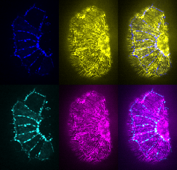Actin/delta-C term HMP-1
a la Andy Warhol