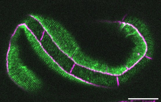 lim-8 (green)/hmp-1(magenta)