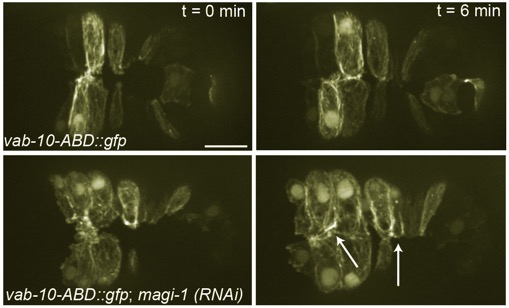 magi-1 actin defects