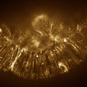 Phalloidin staining, hmp-1(zu278) embryo