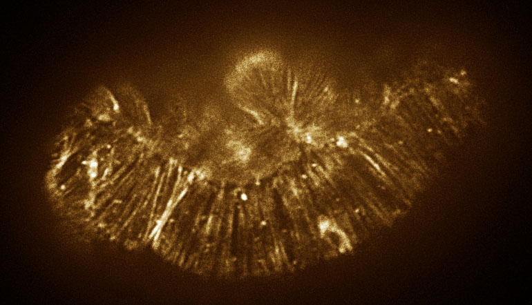 Phalloidin staining, hmp-1(zu278) embryo