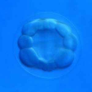 L. variegatus late 16-cell