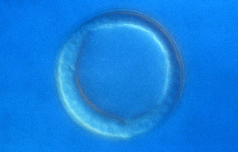 L. variegatus hatched blastula
