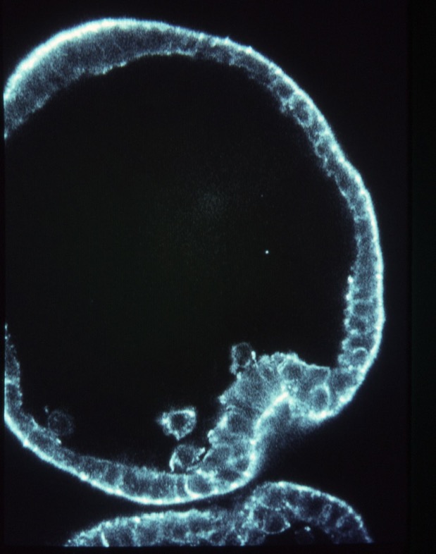 L. pictus early gastrula - phalloidin