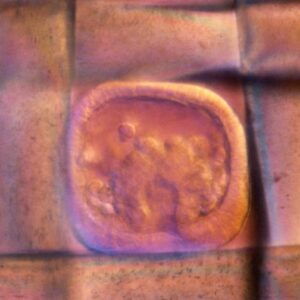 L. variegatus mid-gastrula in Nitex mesh [J. Hardin]